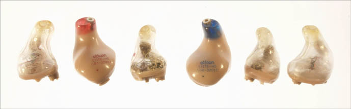 Hearing Loss installation view