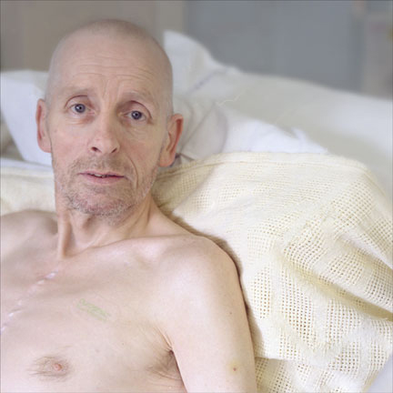 Ian pre-op, Harefield Hospital